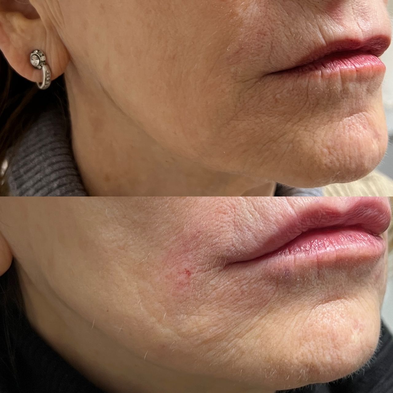 Jacopo Pettinelli-15