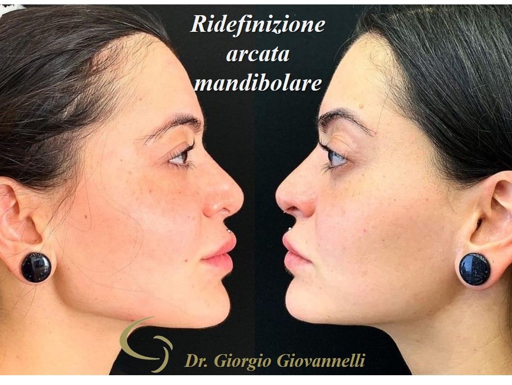 Giorgio Giovannelli-53