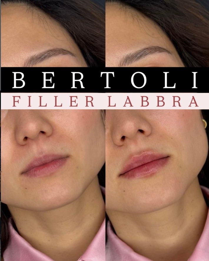 Andrea Bertoli-28