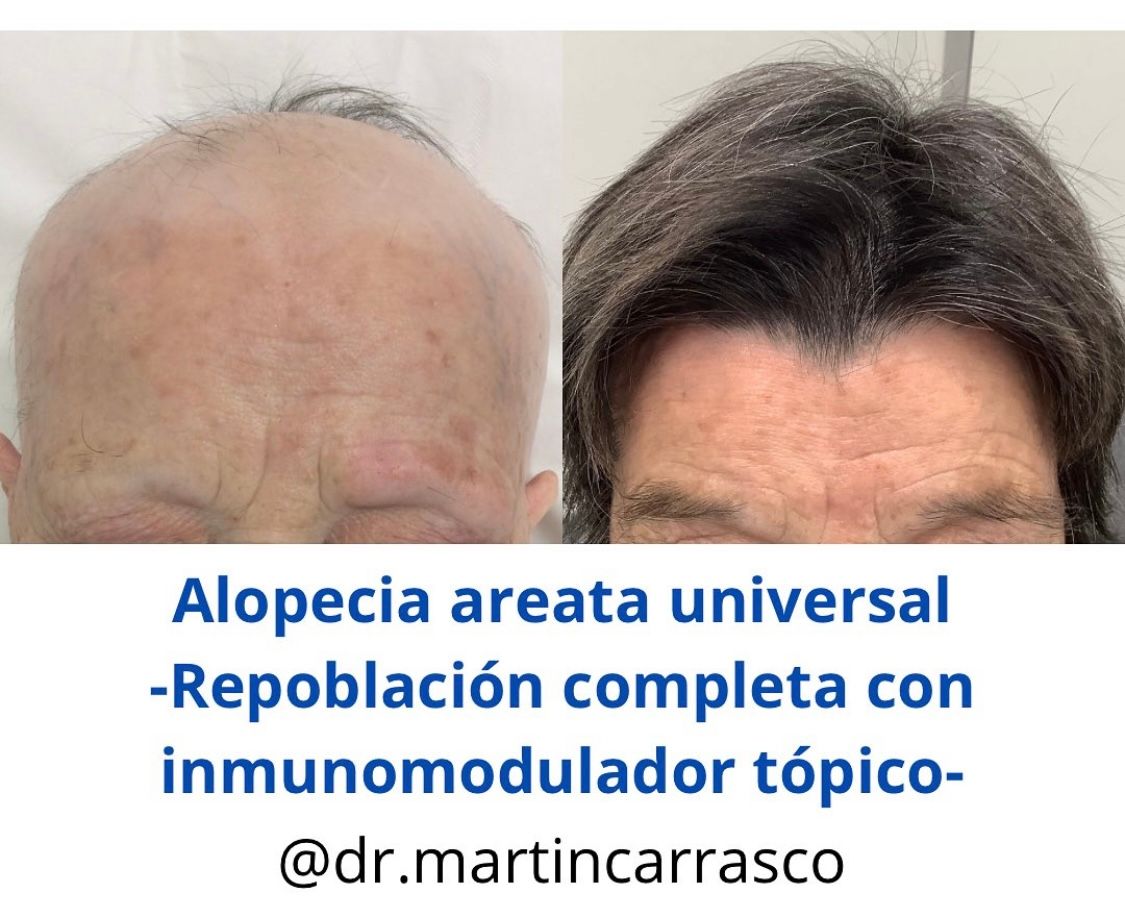 Pablo Martín Carrasco-16