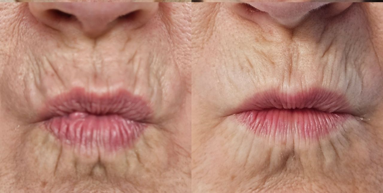 Rosalba Herrero Zerpa-468