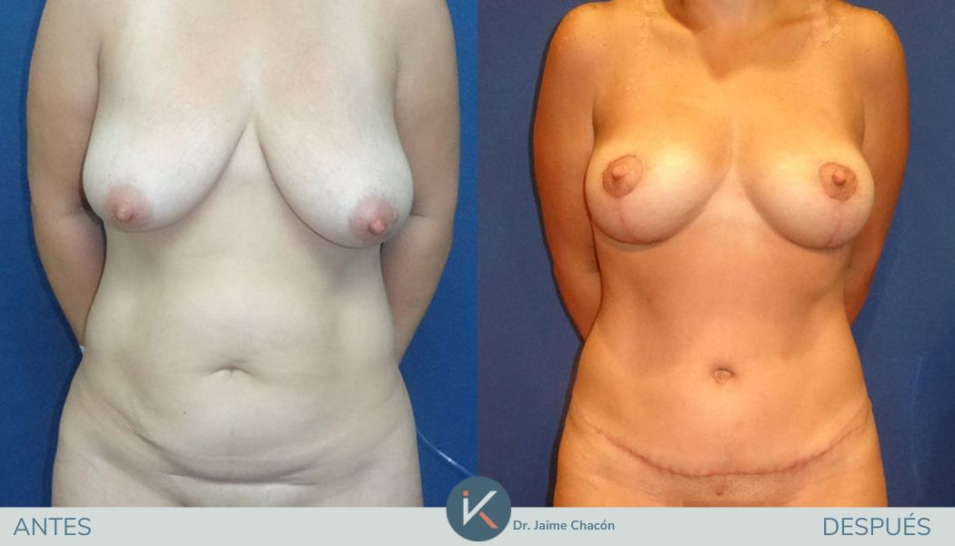 Jaime Eduardo Chacón Hernández-4