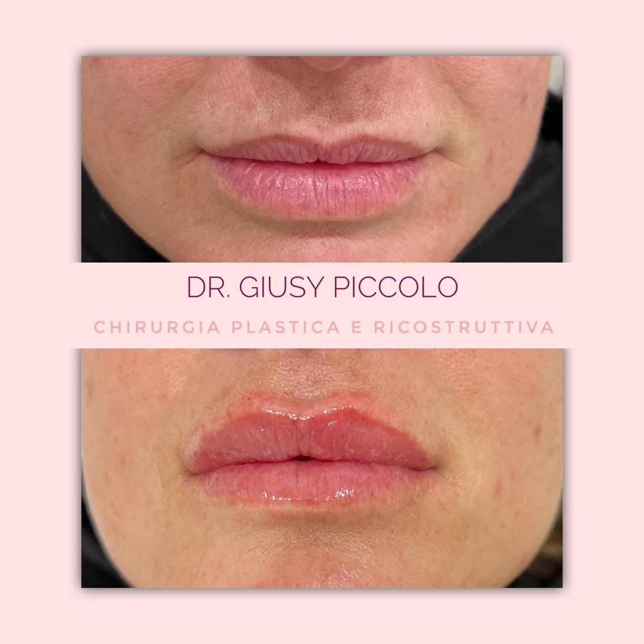 Giuseppina Piccolo-23