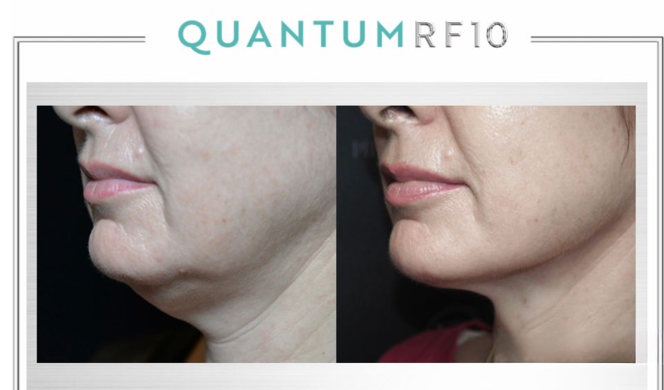 Raffaele Del Prete-19