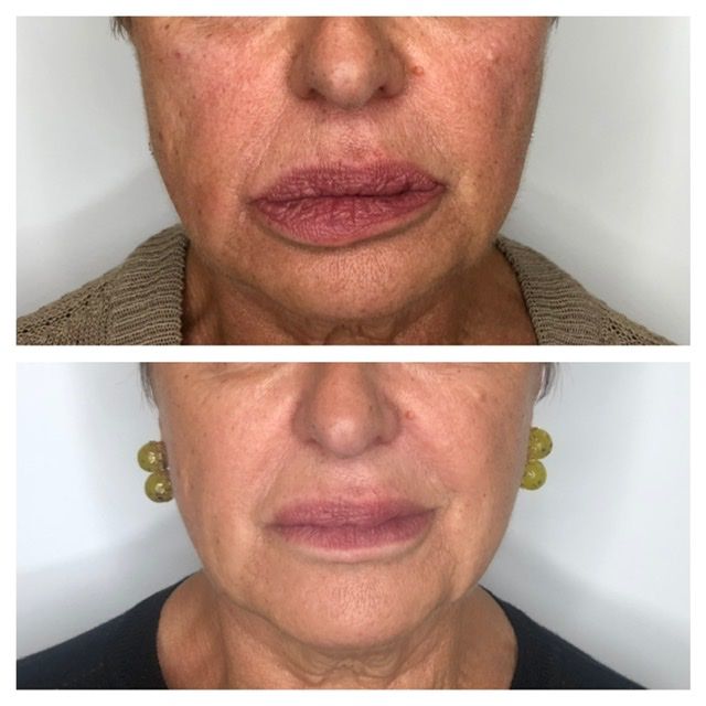 Víctor Hidalgo López-8