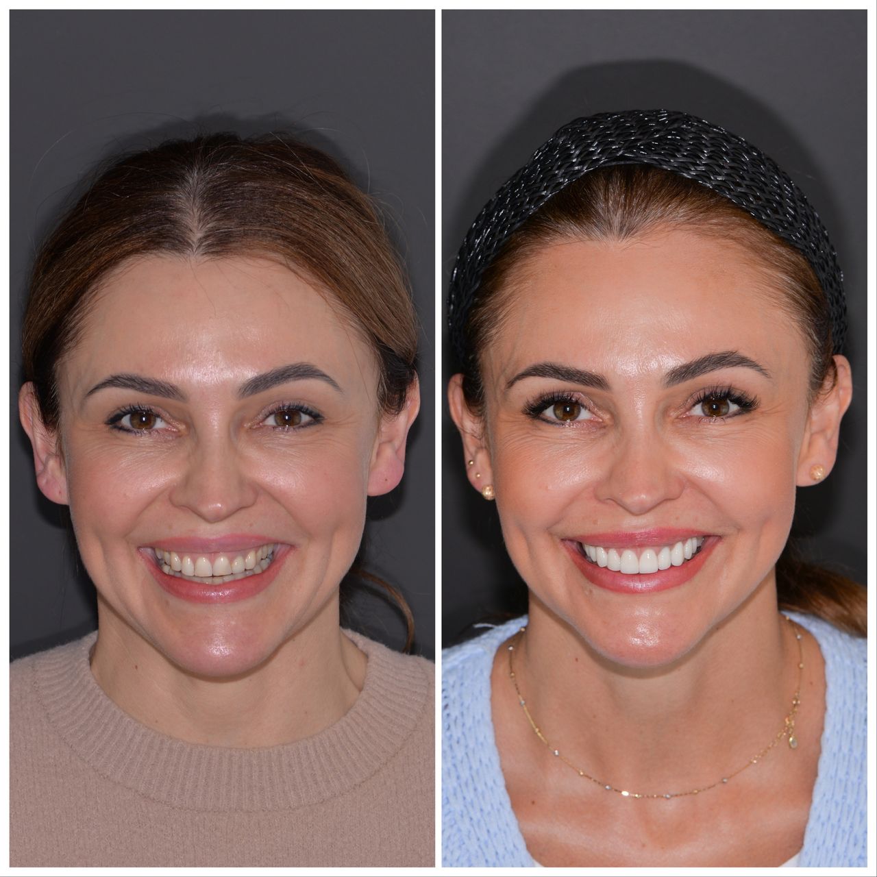 Martin Bartoszcze-34