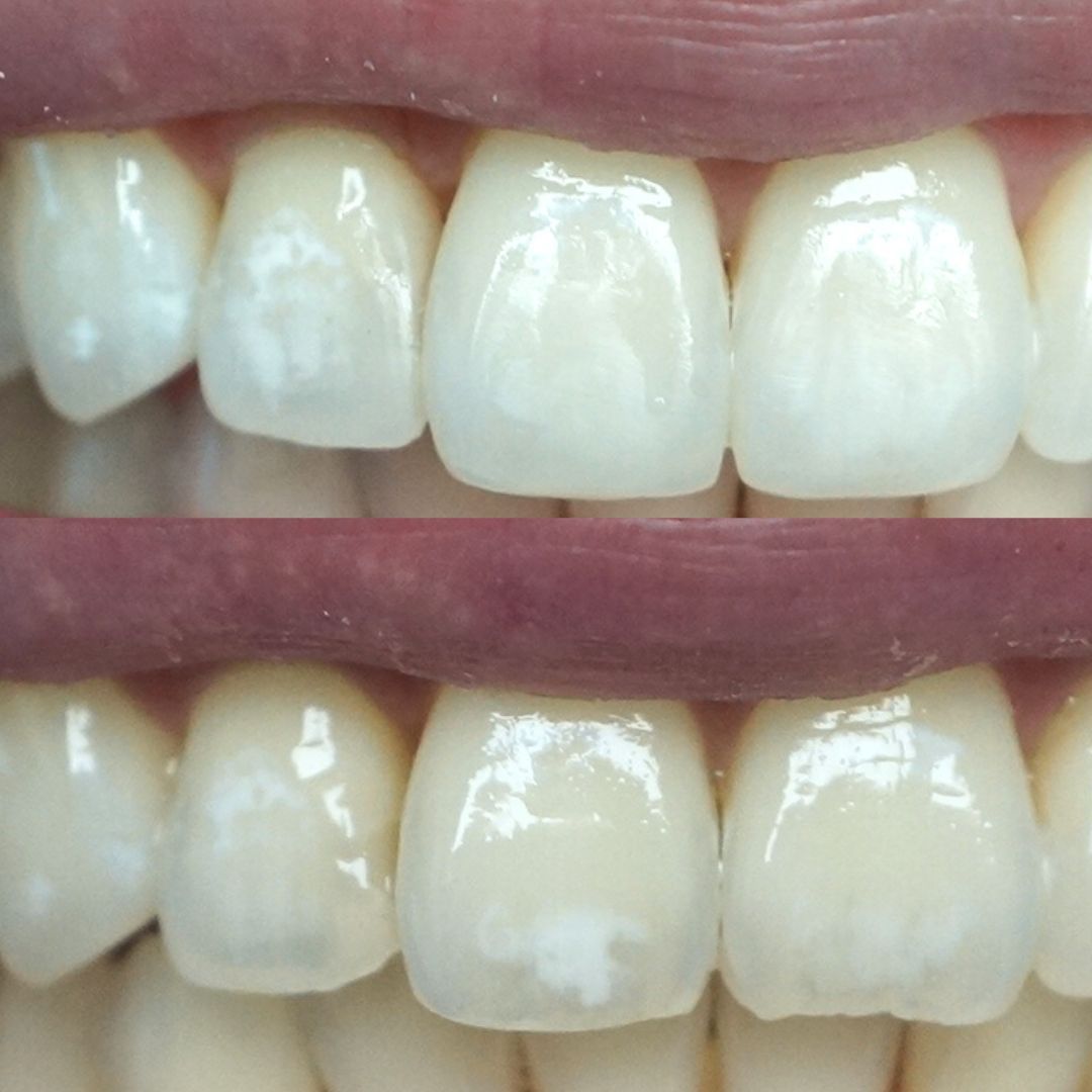 Raimonda Bogdanoviciute-27