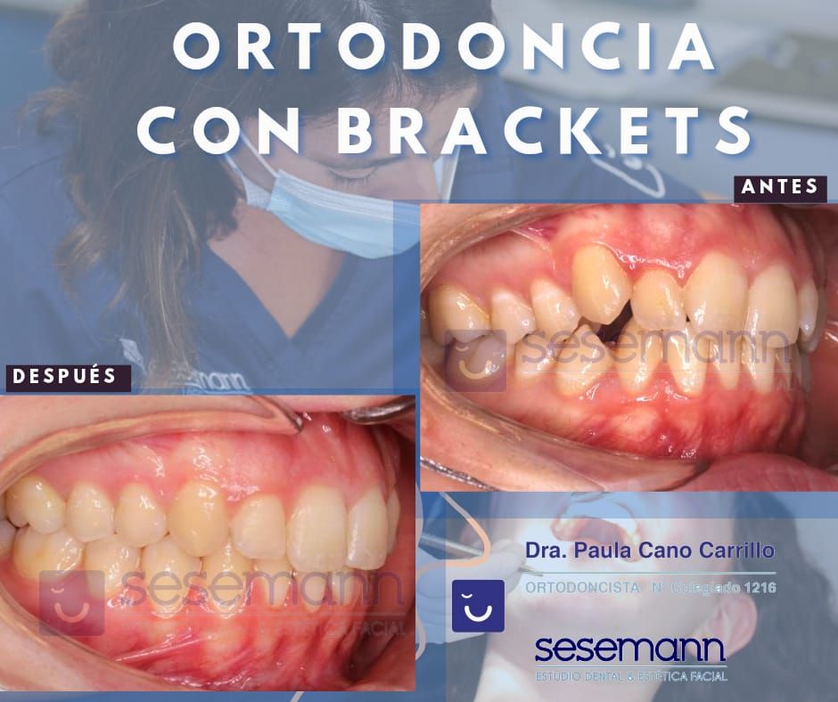 Paula Cano Carrillo-12