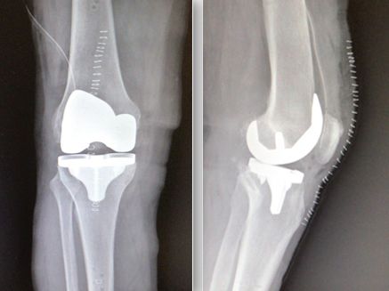 Nikita Matveitchouk-3