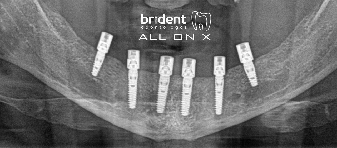Guillermo Moreno Fragoso-33