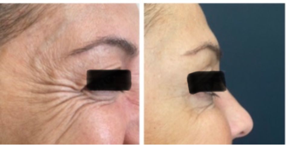 Silvia Melania Baio-8