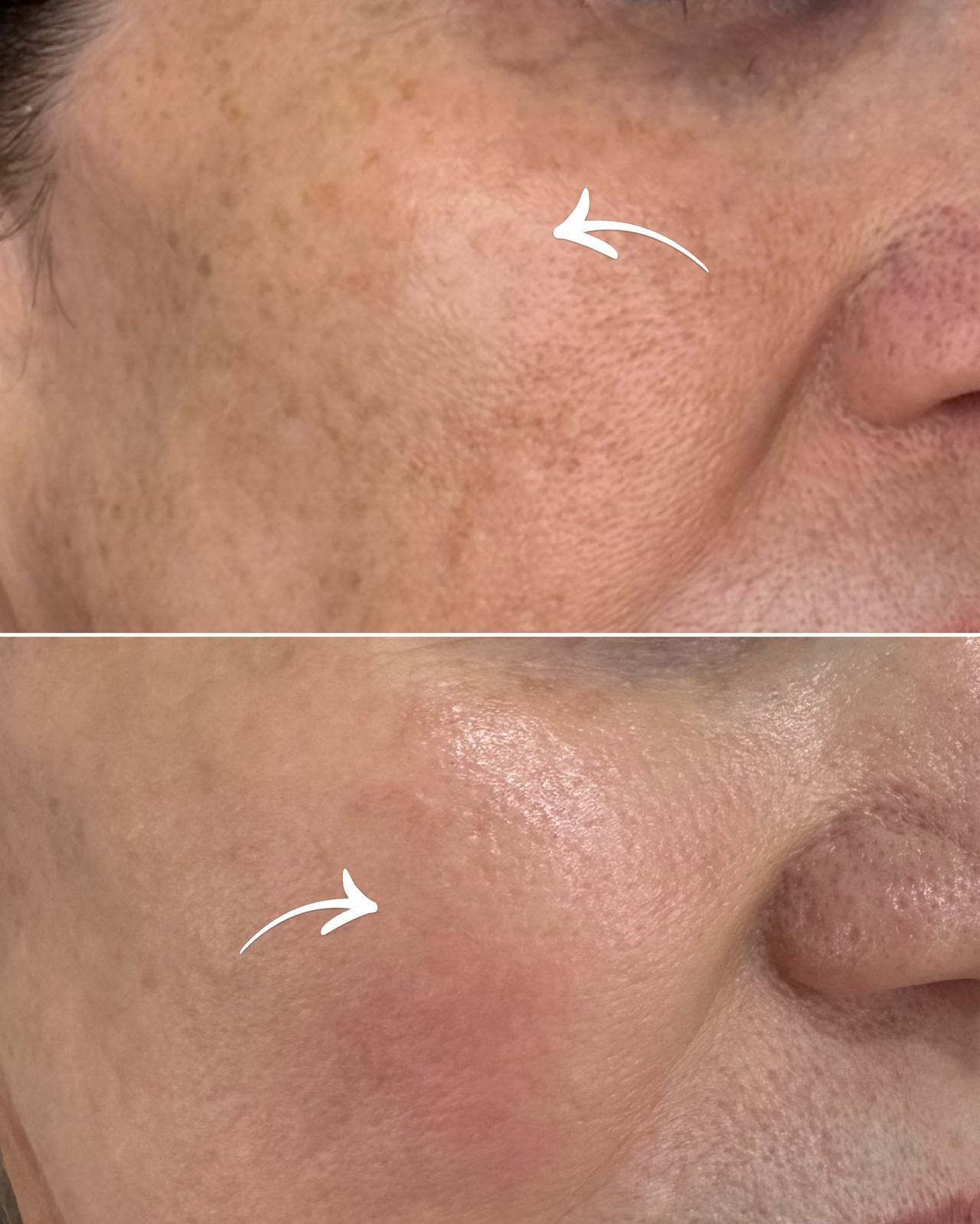 Yolimar Acevedo Raya-2