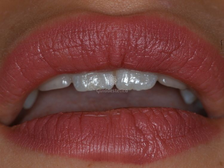 Alessandro Palumbo-55