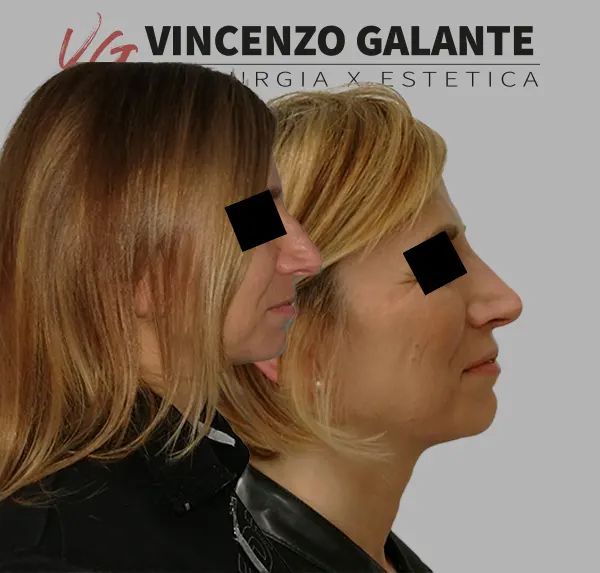 Vincenzo Galante-2