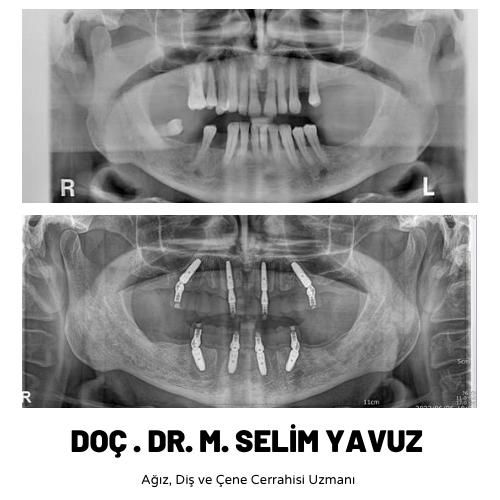 Muhammed Selim Yavuz-18