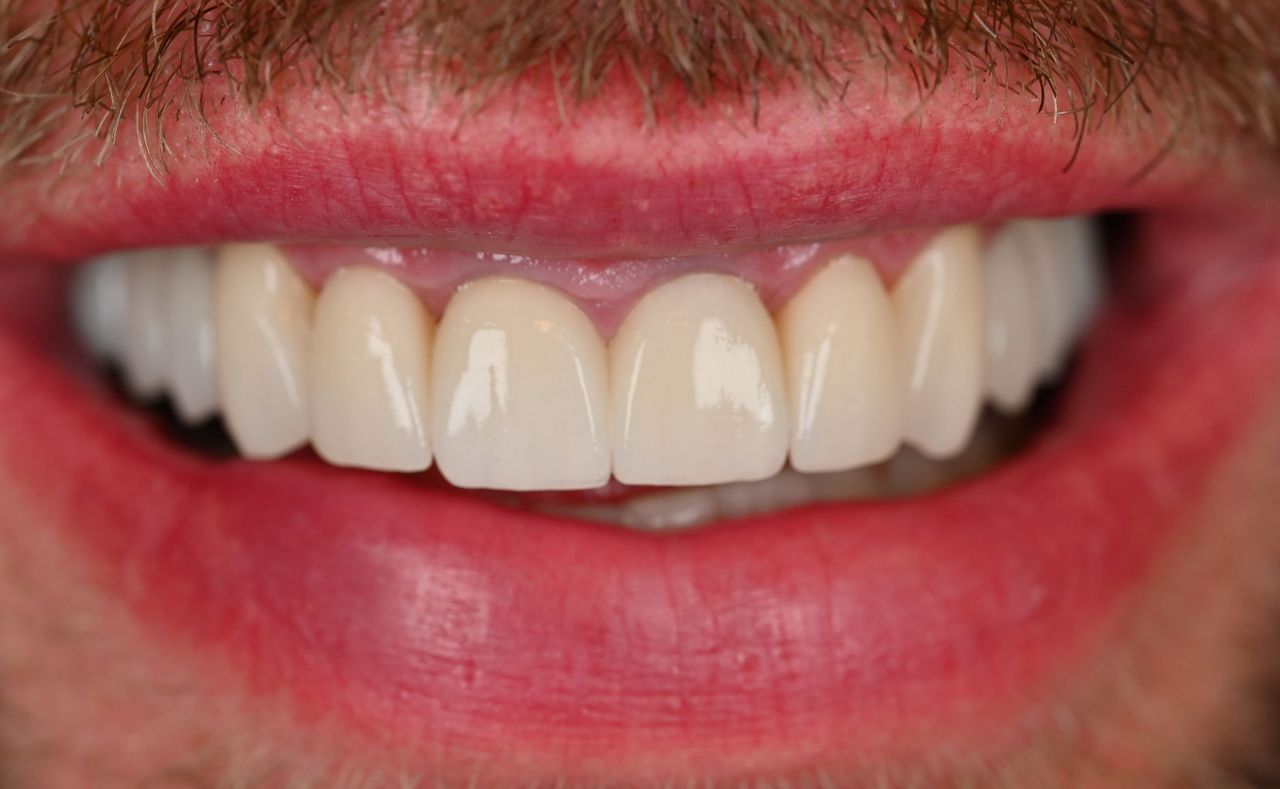 Magdalena Bińkowska-22