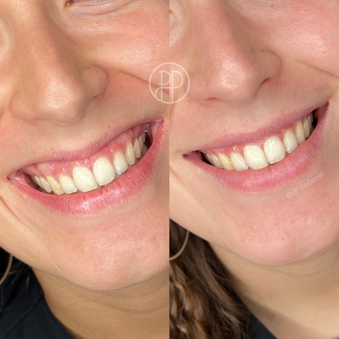 Liliana Paola Pellecer Ruiz-9