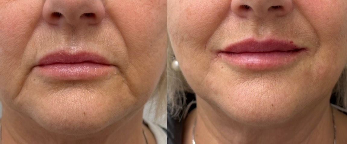 Maria Carmen Stabile-55