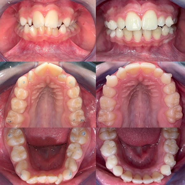 Antonio Pietrobattista-1