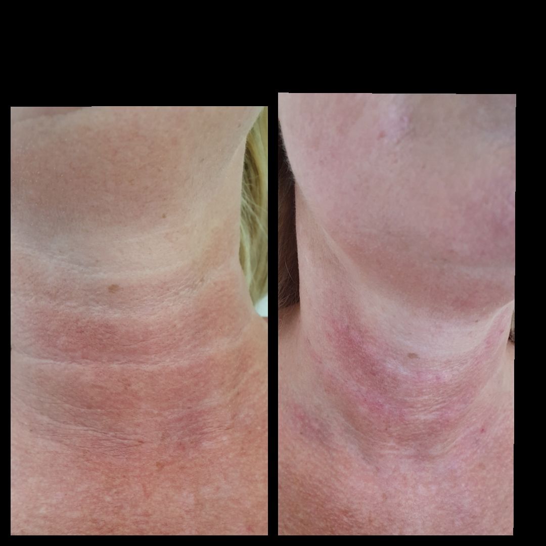 Andrea Menichelli-14