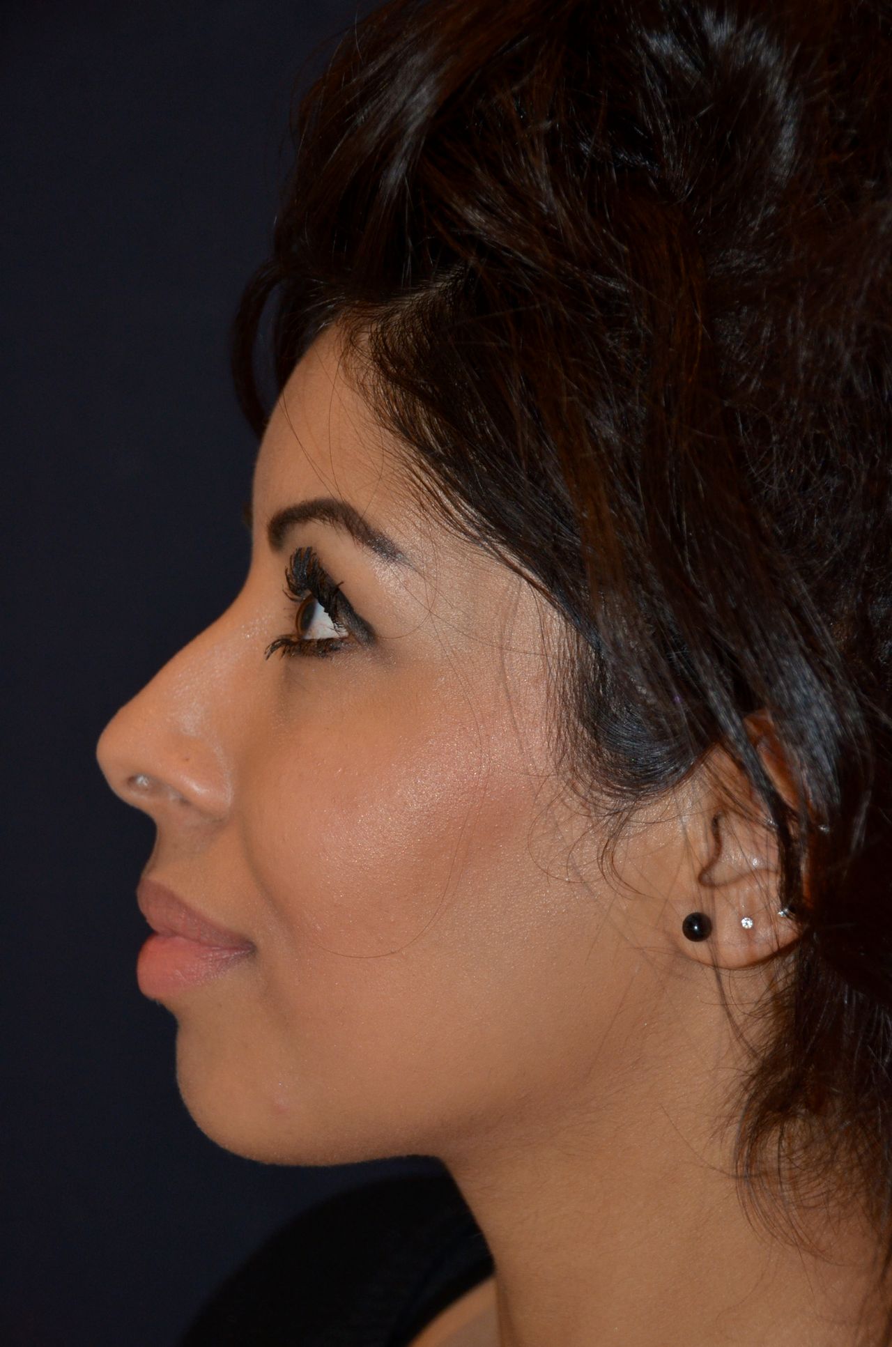 Christoffer Ingves-23