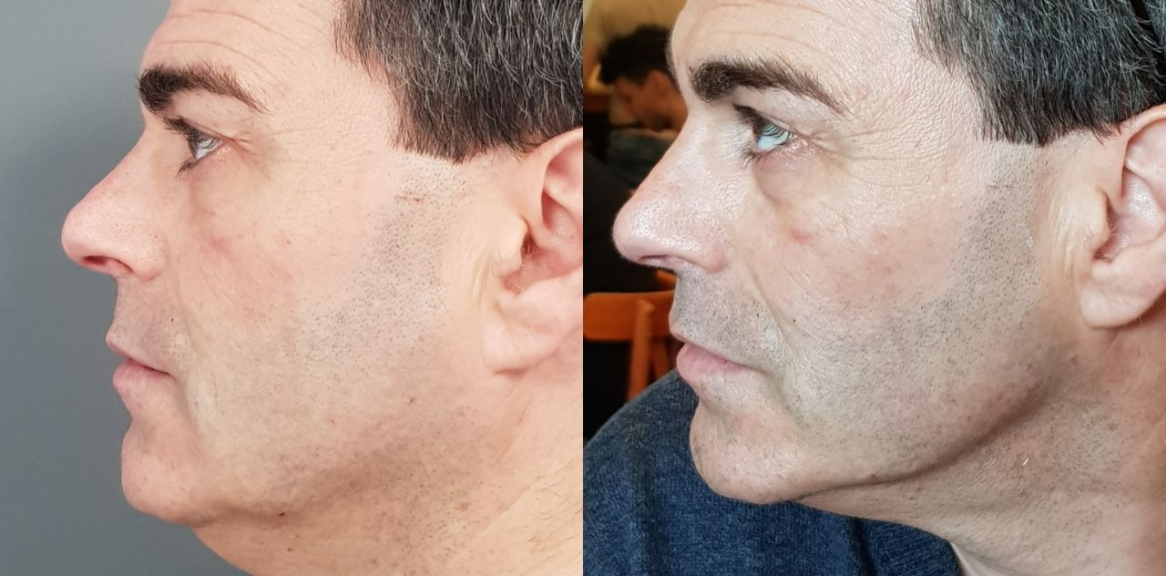 Rosalba Herrero Zerpa-159