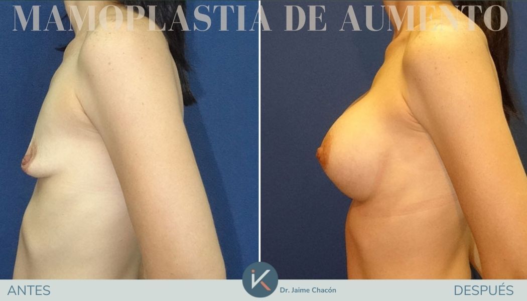 Jaime Eduardo Chacón Hernández-13