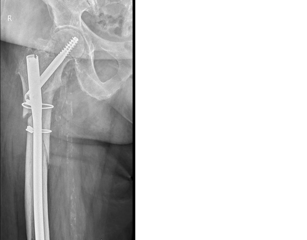 Mateusz Orzechowski-8