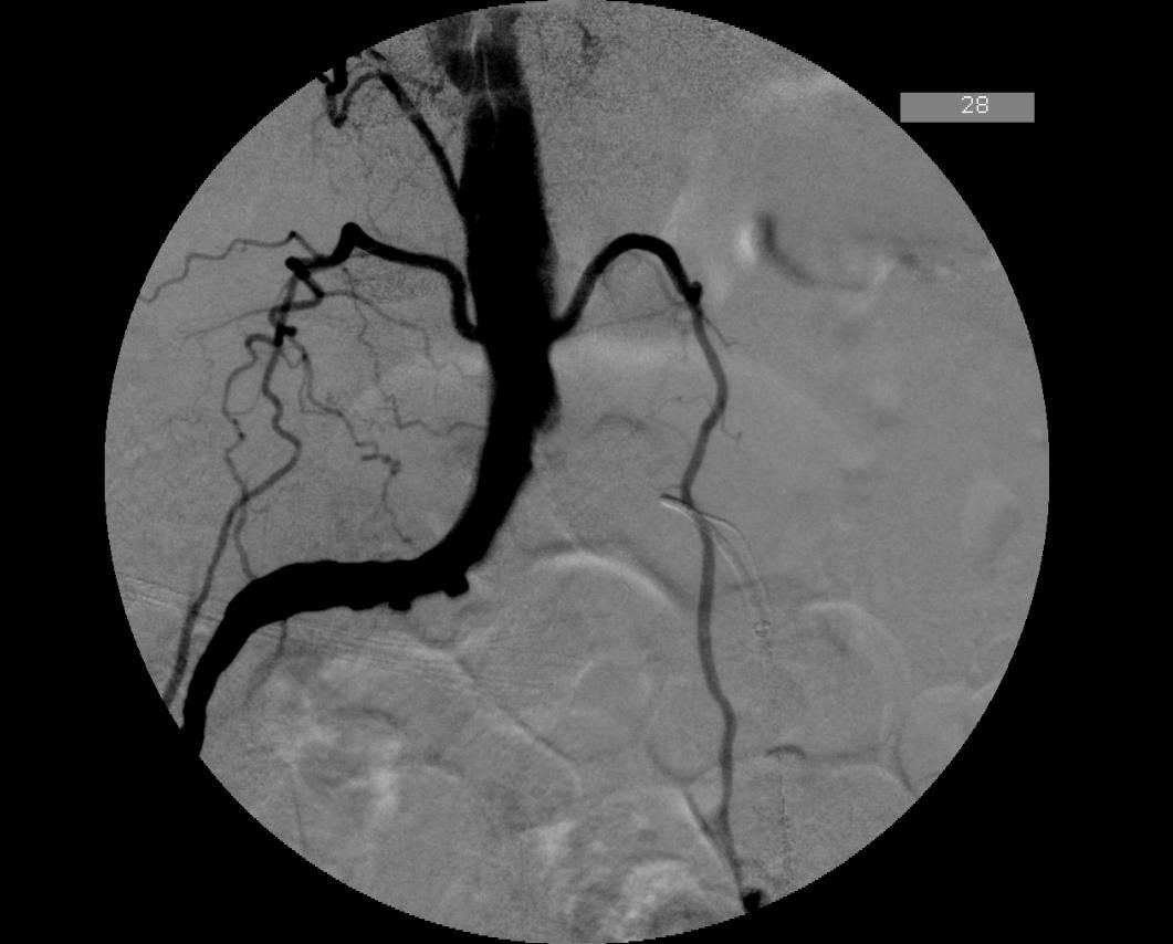 Francesco De Santis-11