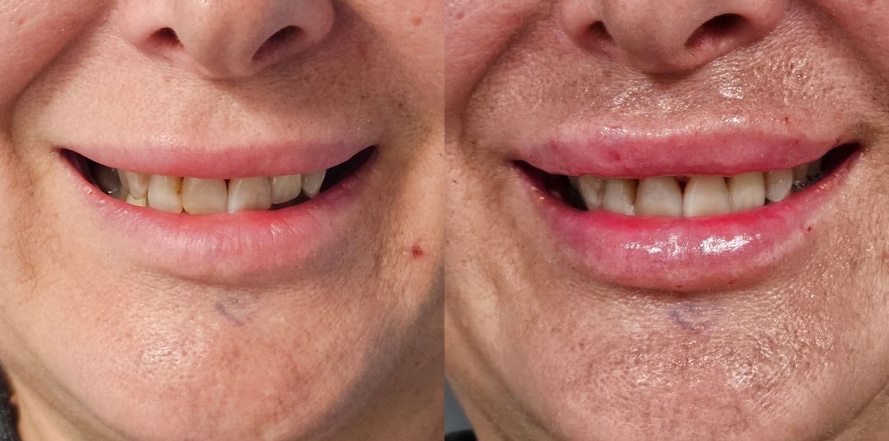 Rosalba Herrero Zerpa-578