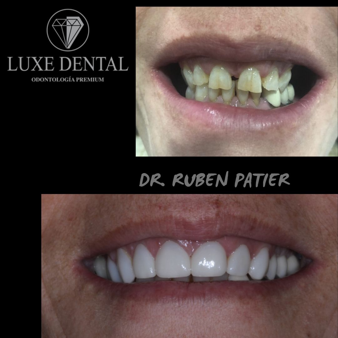 Ruben Patier Martin-29