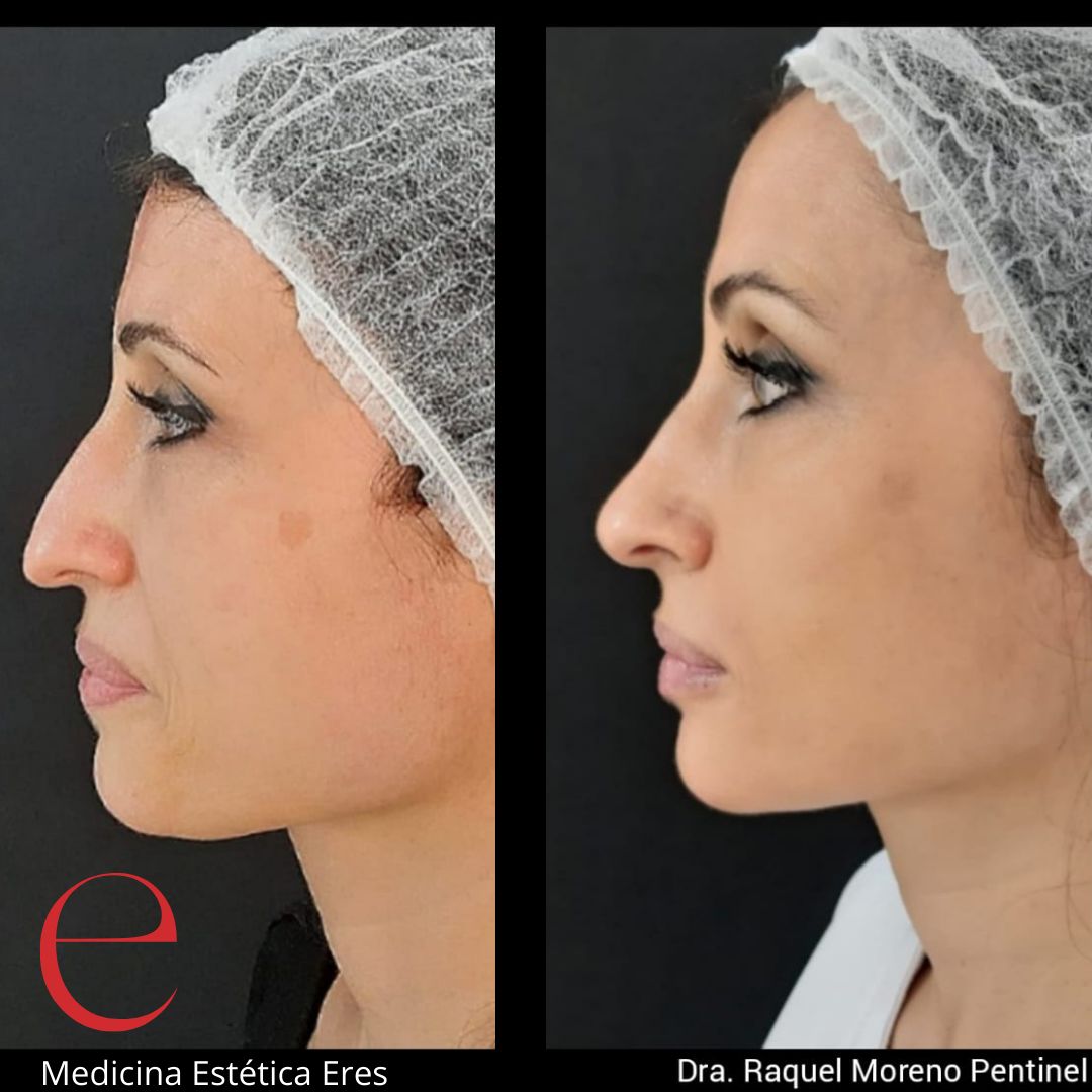 Raquel Moreno Pentinel-87