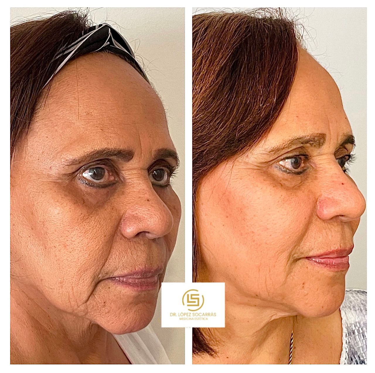 Camilo López Socarrás-11