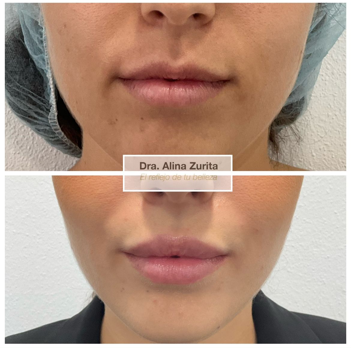 Alina Zurita Estarrona-1