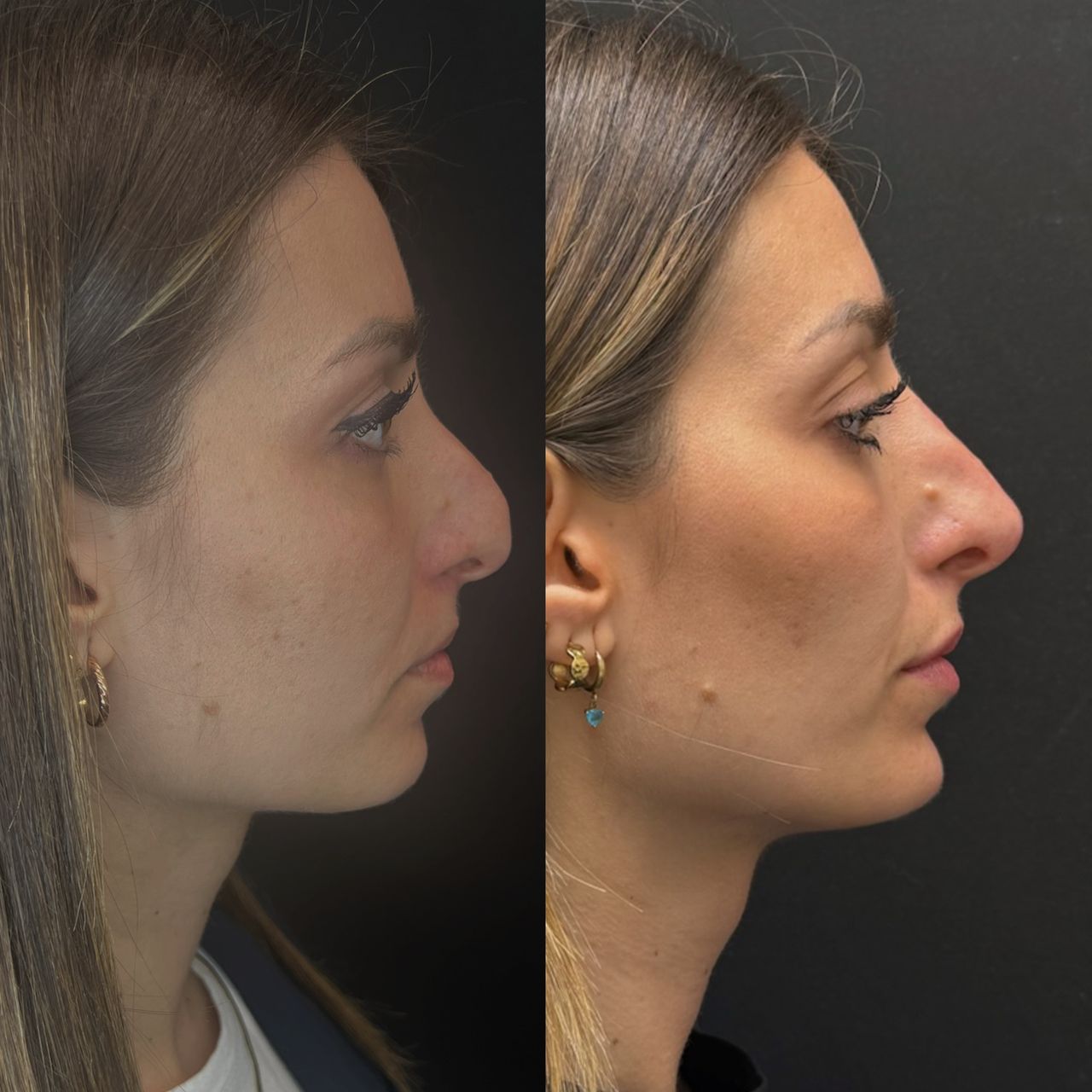 Emilia Frappampina-7