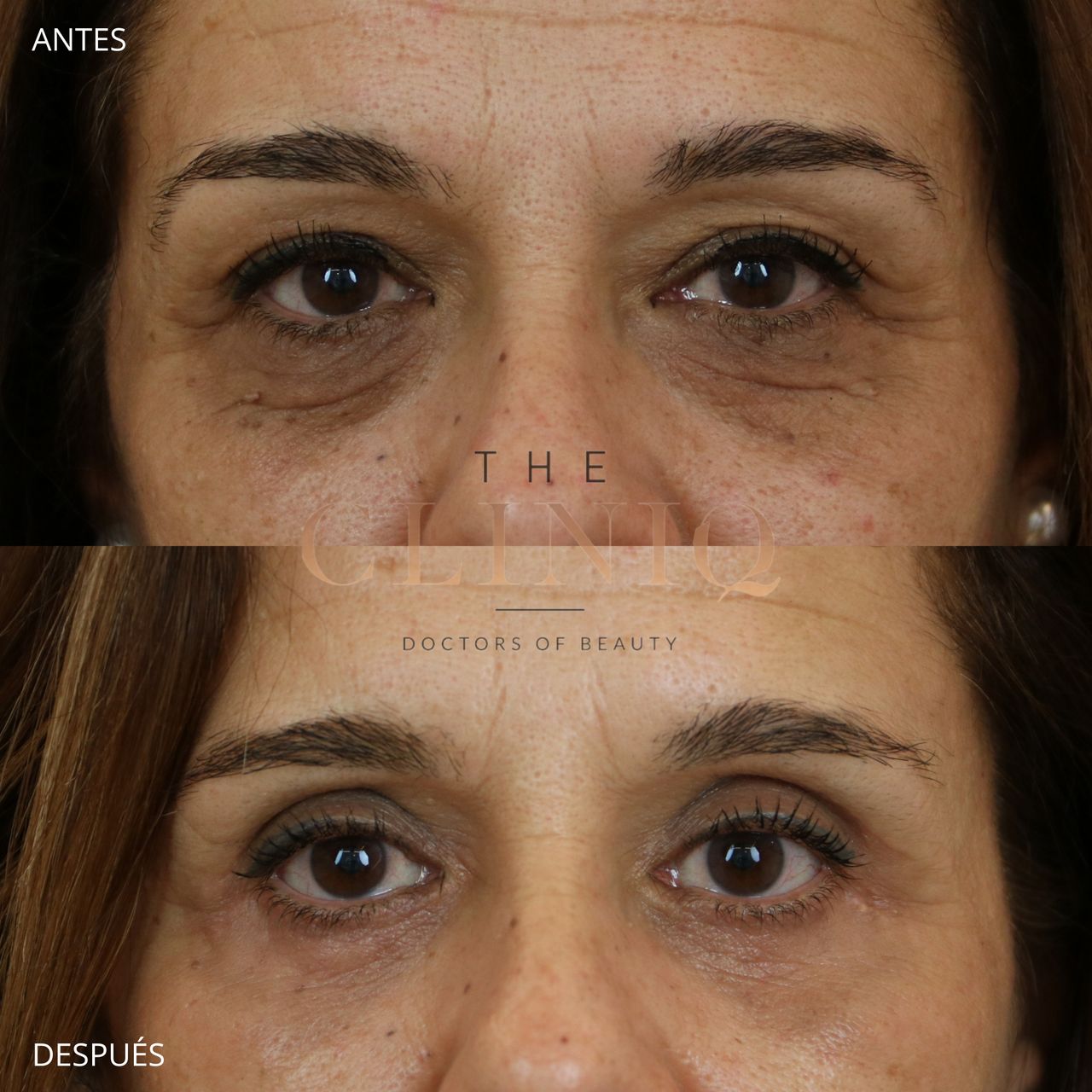 Ignacio Genol Saavedra-4