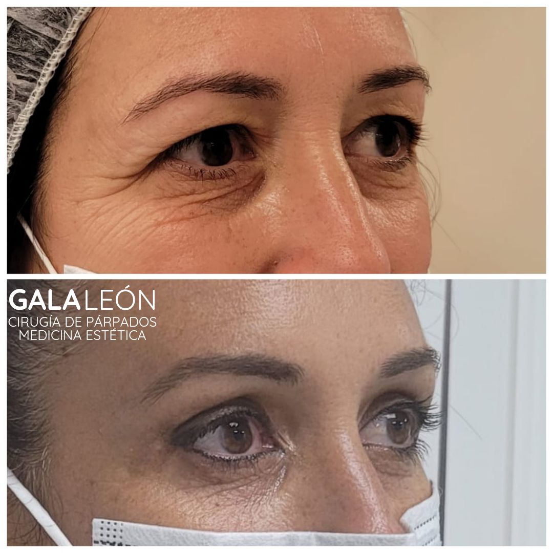 Gala P. Leon Salvatierra-15