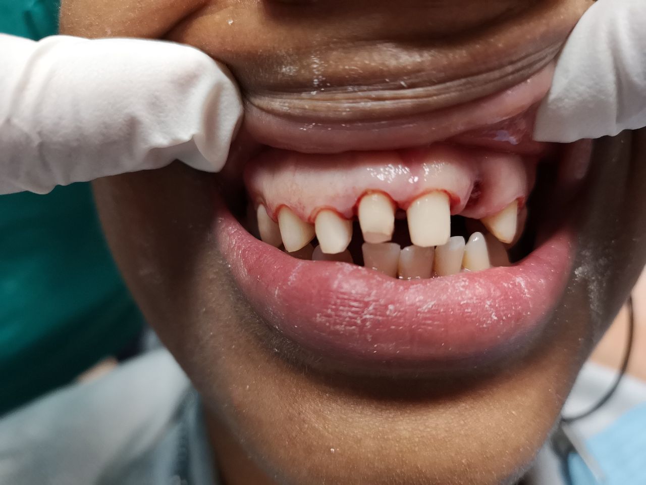 Stefano De Simone-37