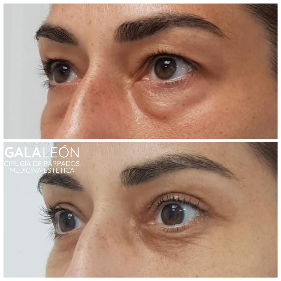 Gala P. Leon Salvatierra-14