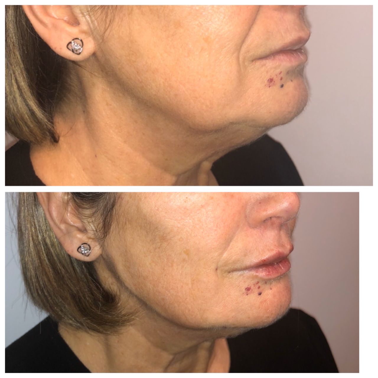 Víctor Hidalgo López-11