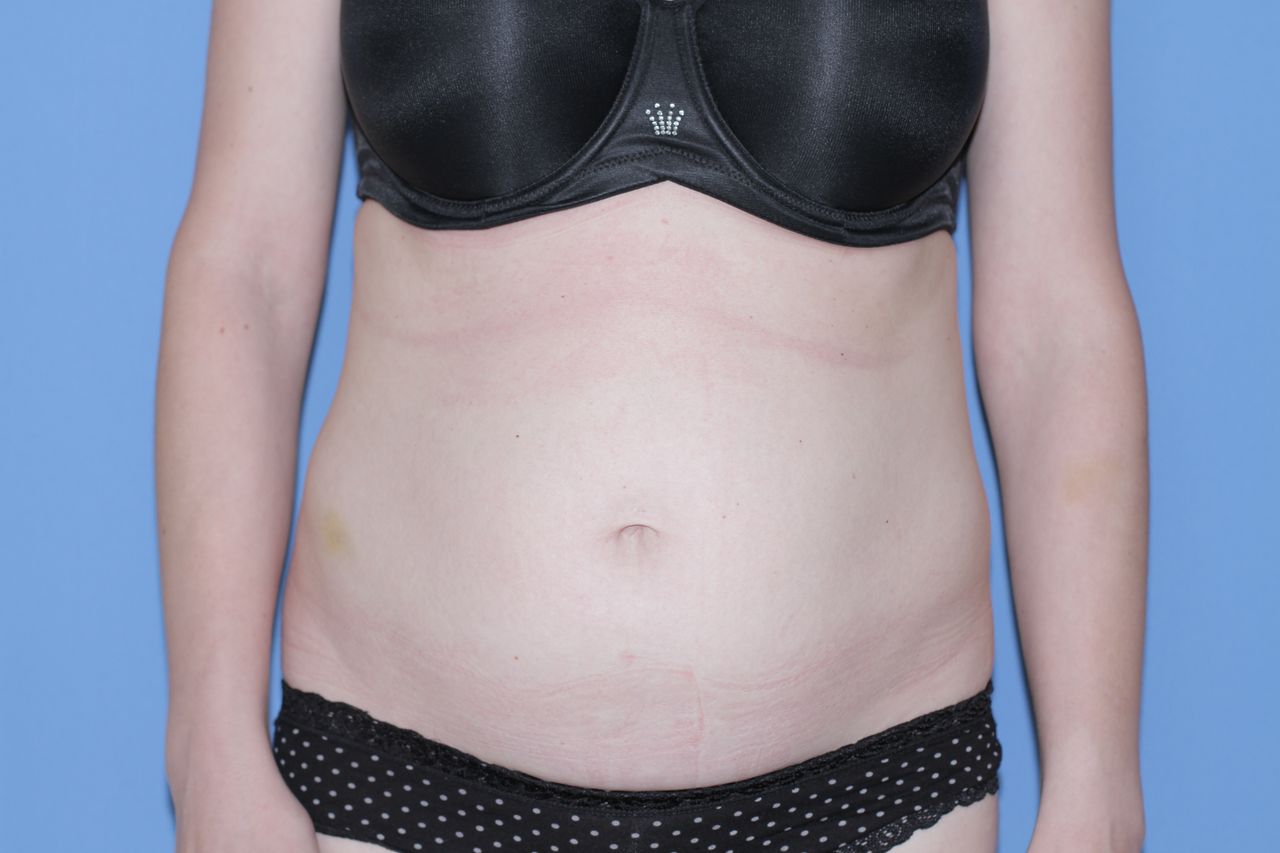 Maciej Charaziński-136