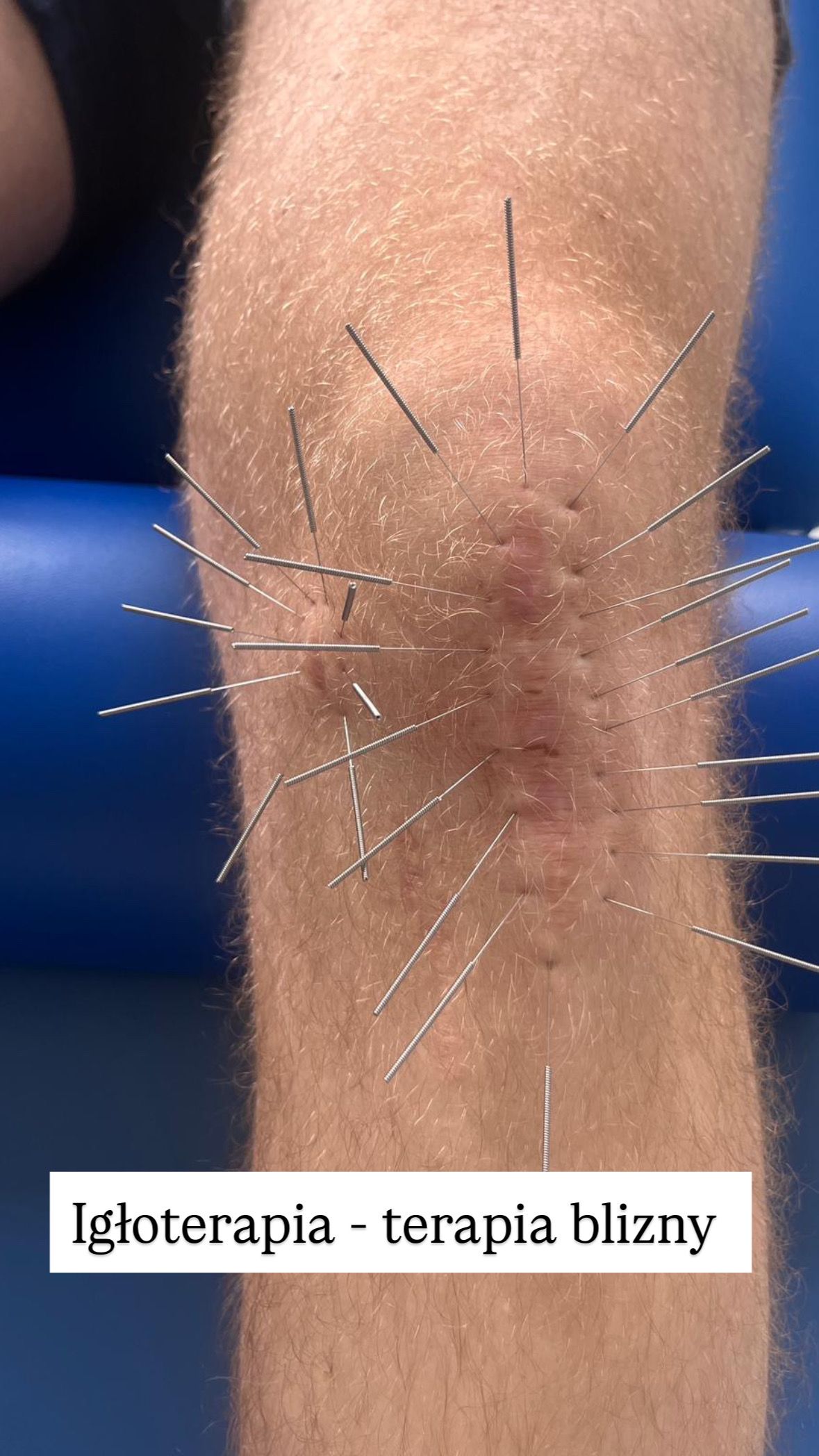 Malwina Bandrowska-0