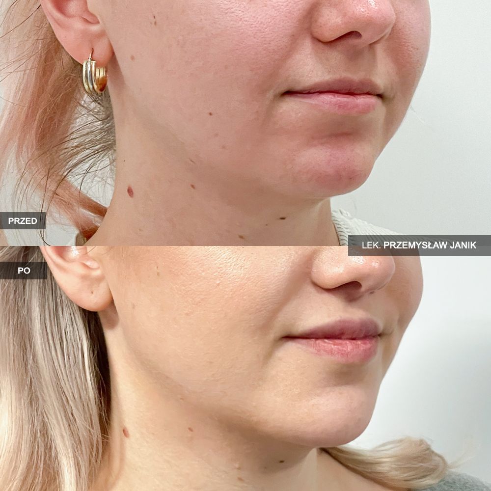 Przemysław Janik-42