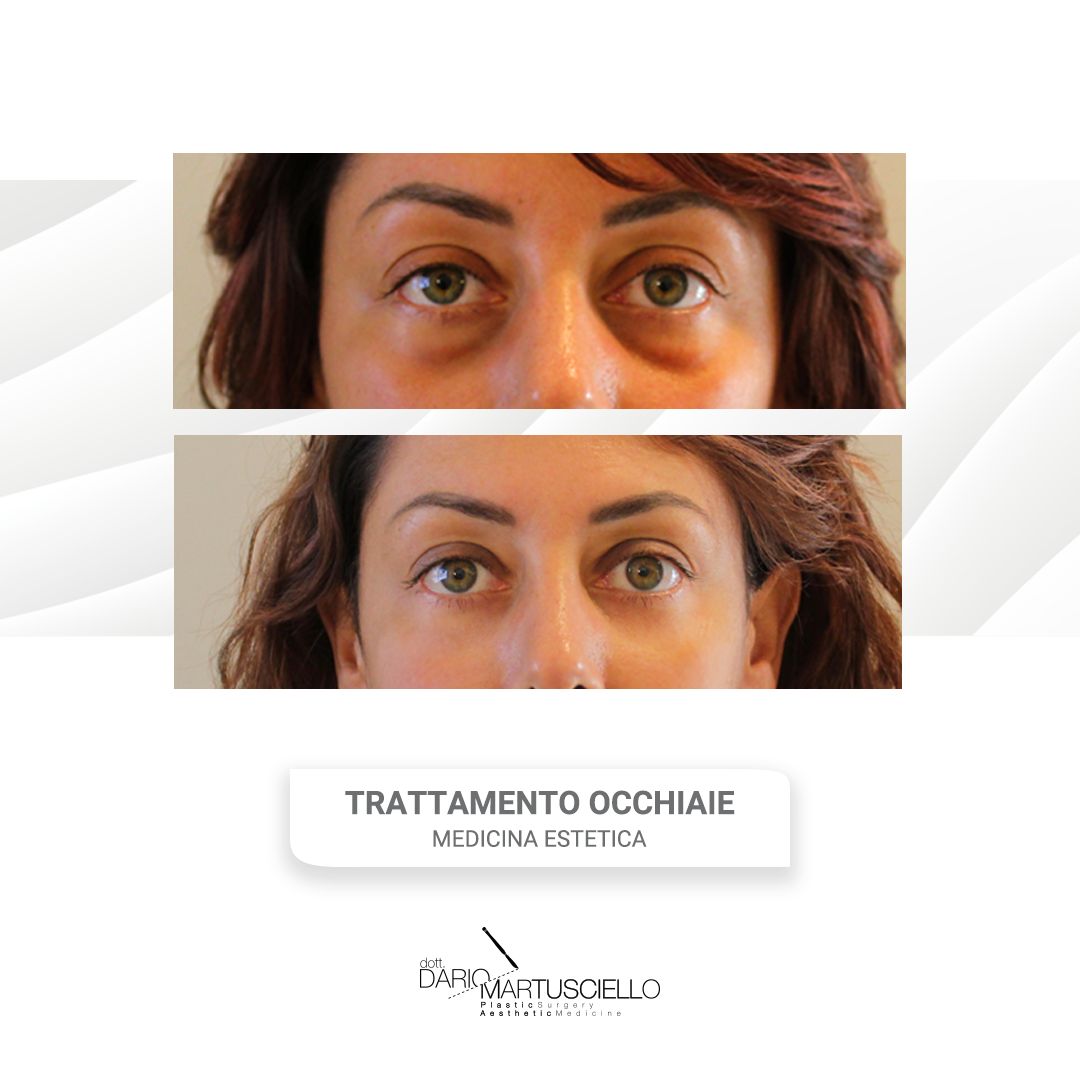 Dario Martusciello-6