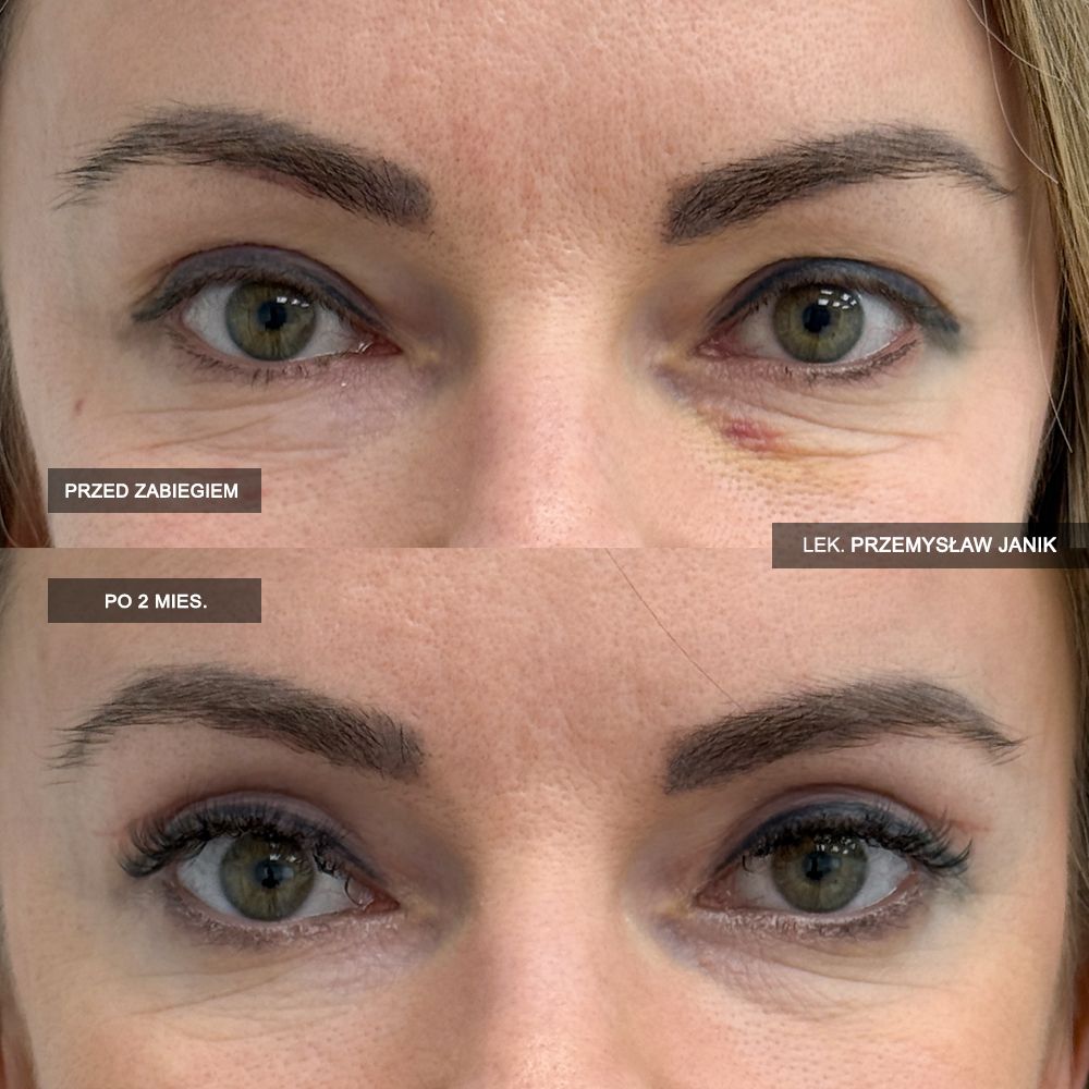 Przemysław Janik-60