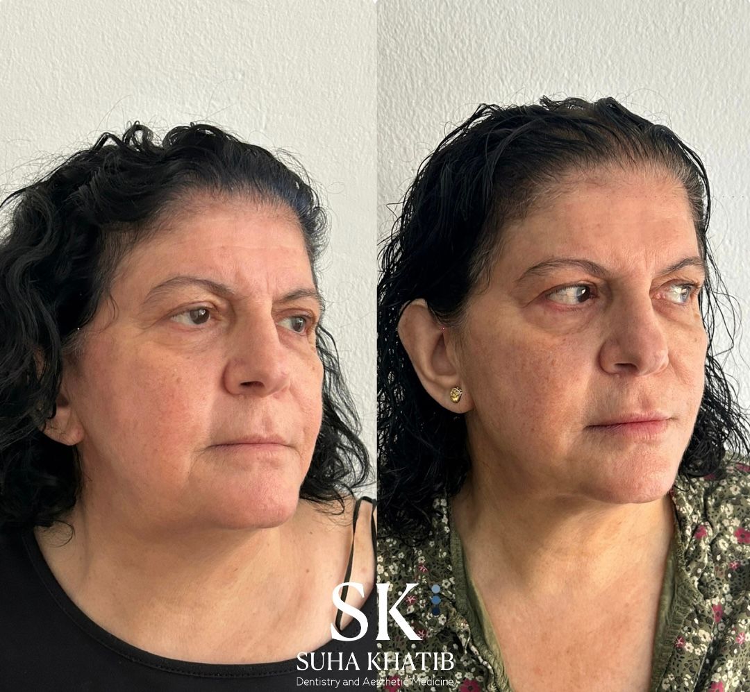 Suha Khatib-7