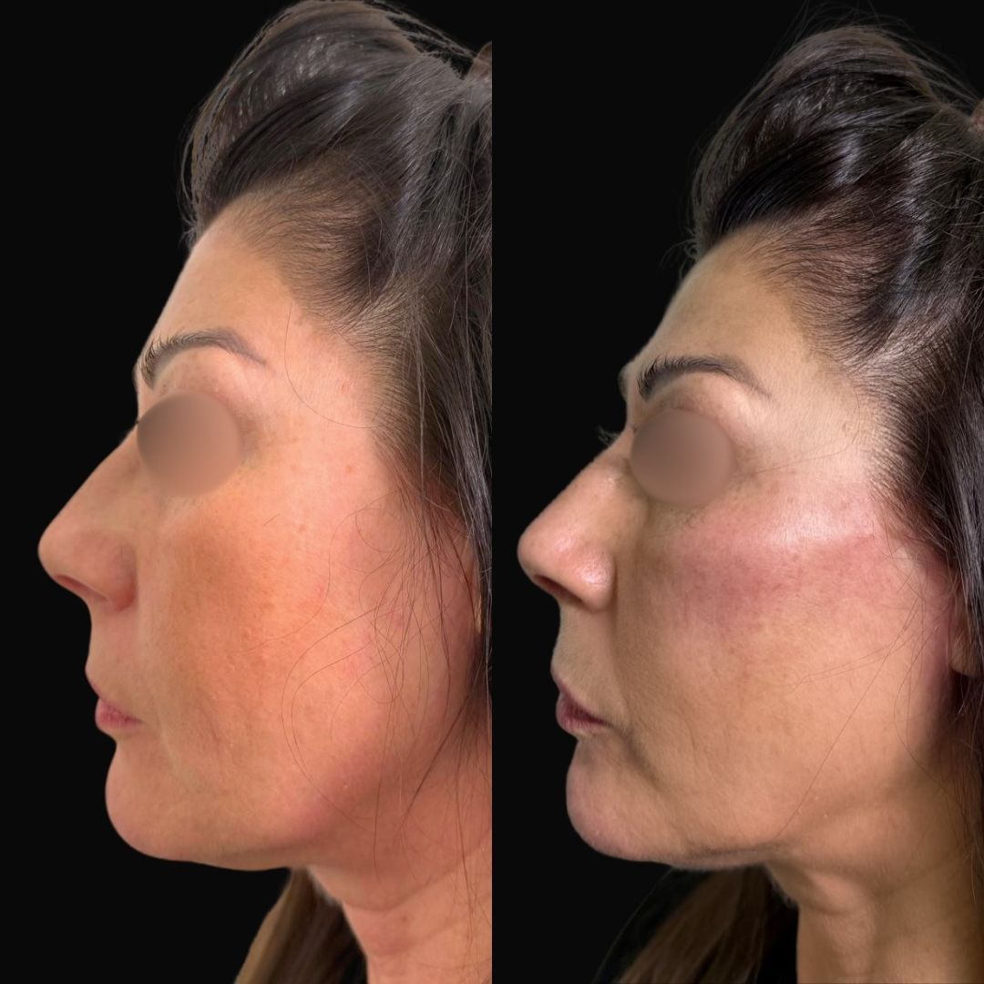 Pierfederico Perazzini-5