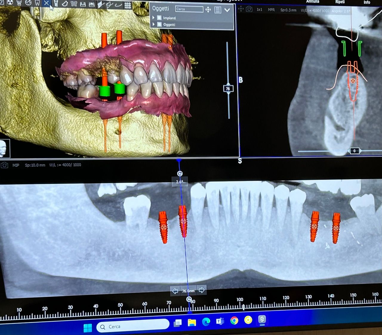 Pasquale Cozzolino-8