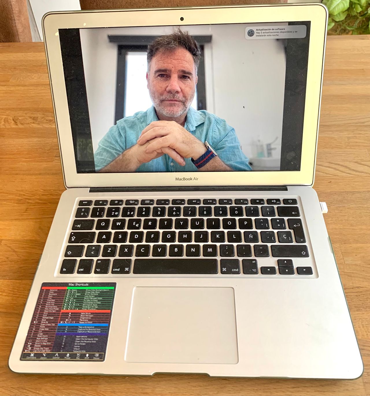 Diego Carranza Tresoldi-2