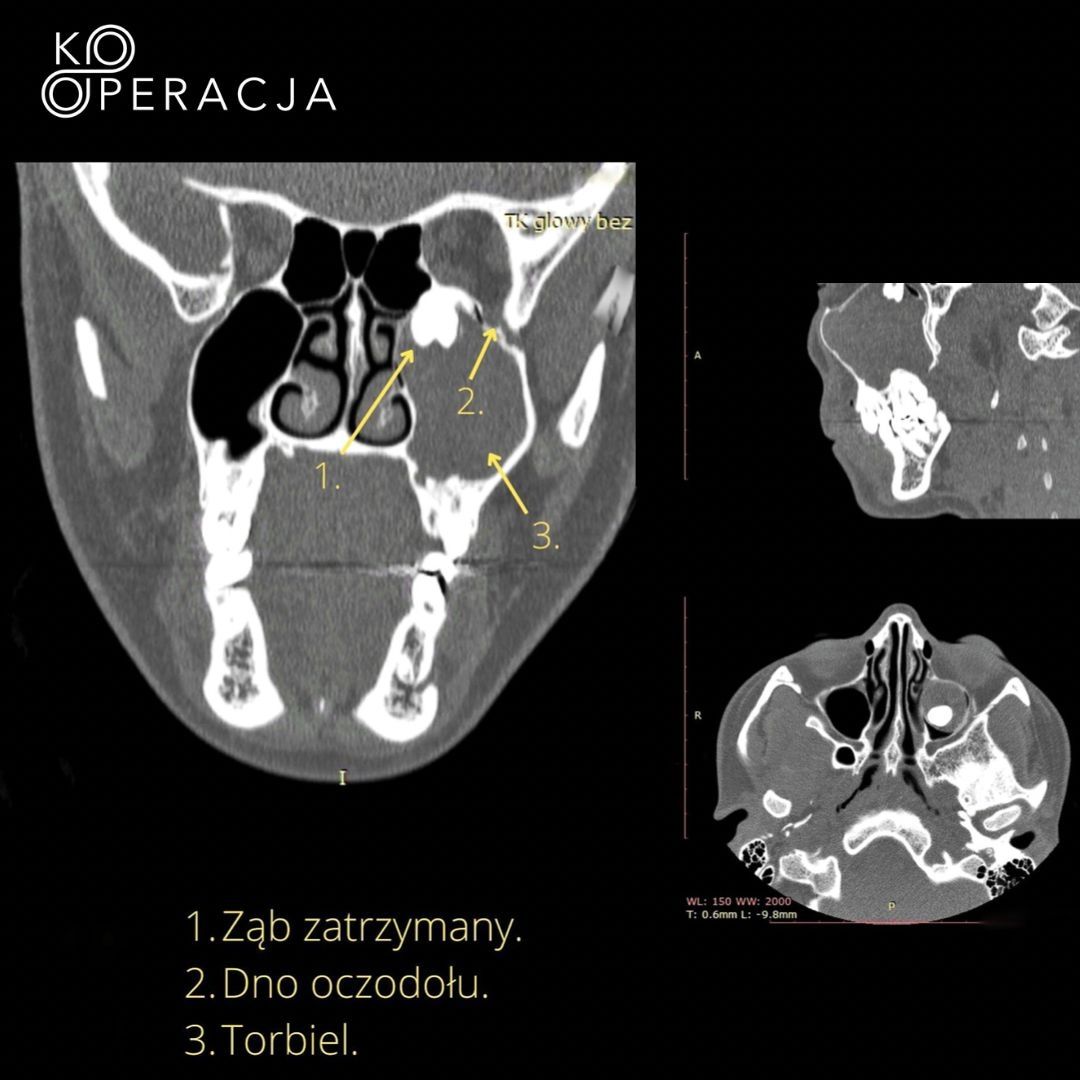 Paweł Poniatowski-19